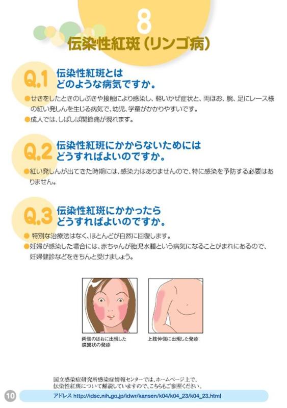 伝染性紅斑(りんご病)